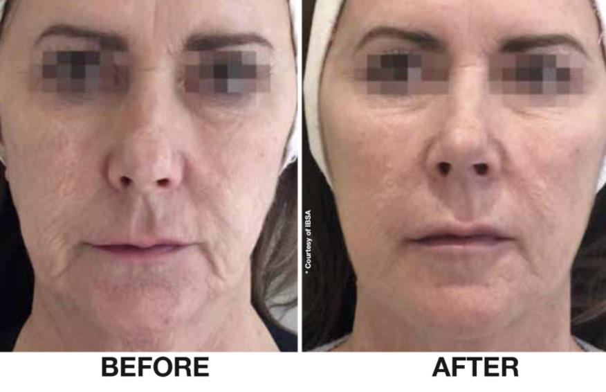 Before & After 1