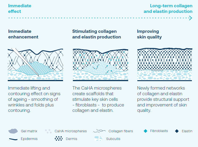 How Radiesse Works Diagram