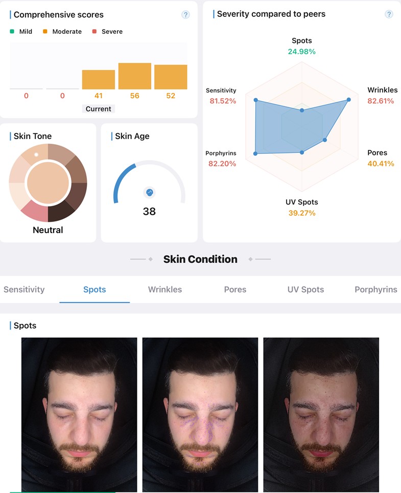 skin analyser