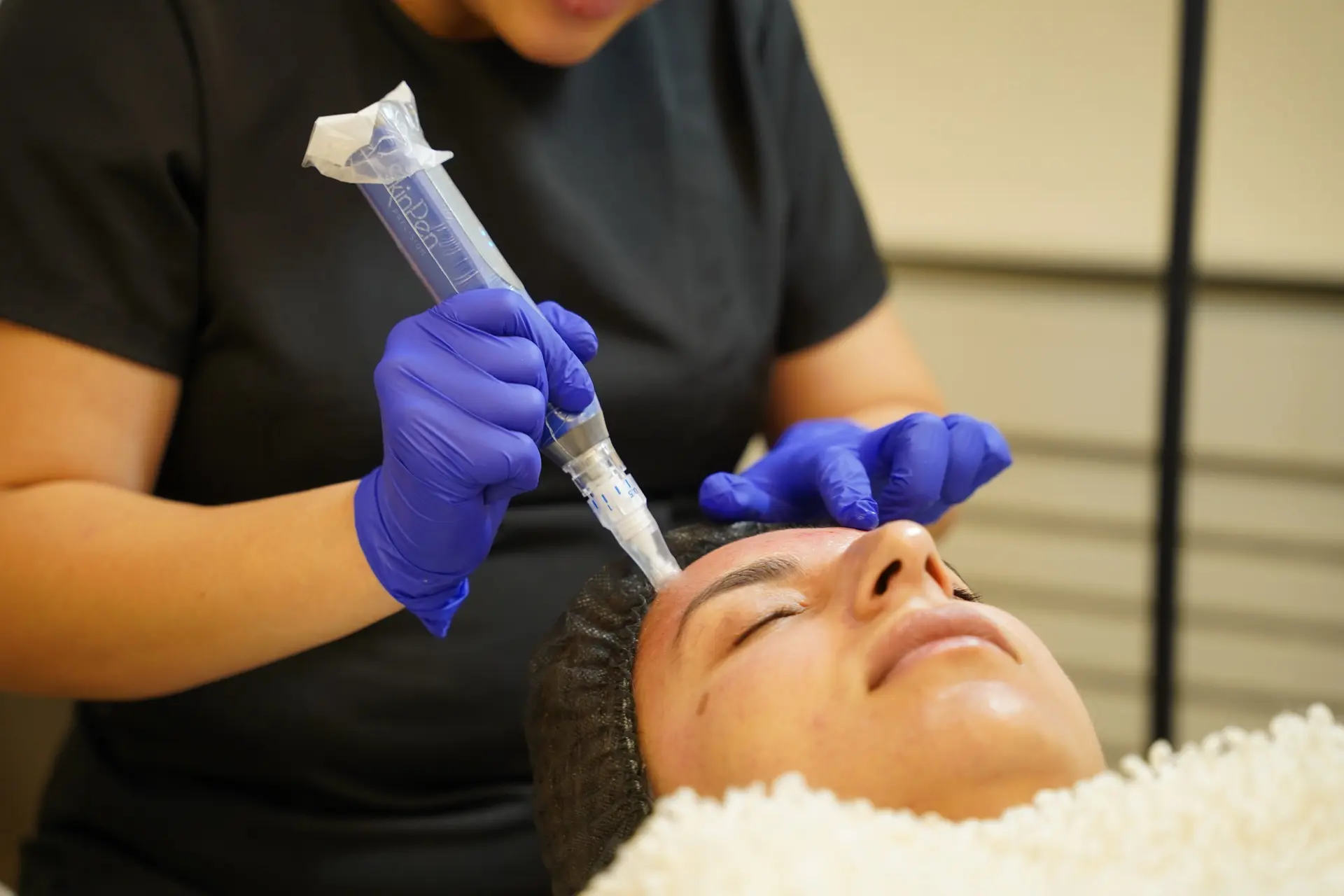 Microneedling