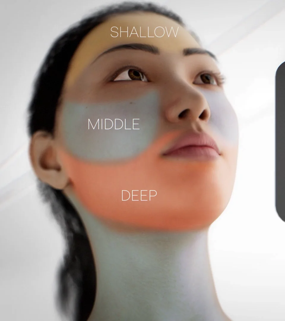 XERF shallow, middle and deep treatment zones mapped across a face beside the device console